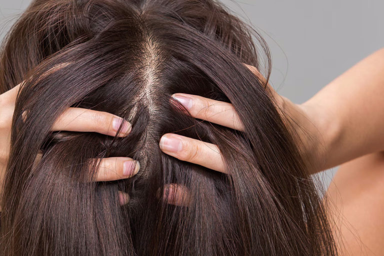 Blog 1 Scalp